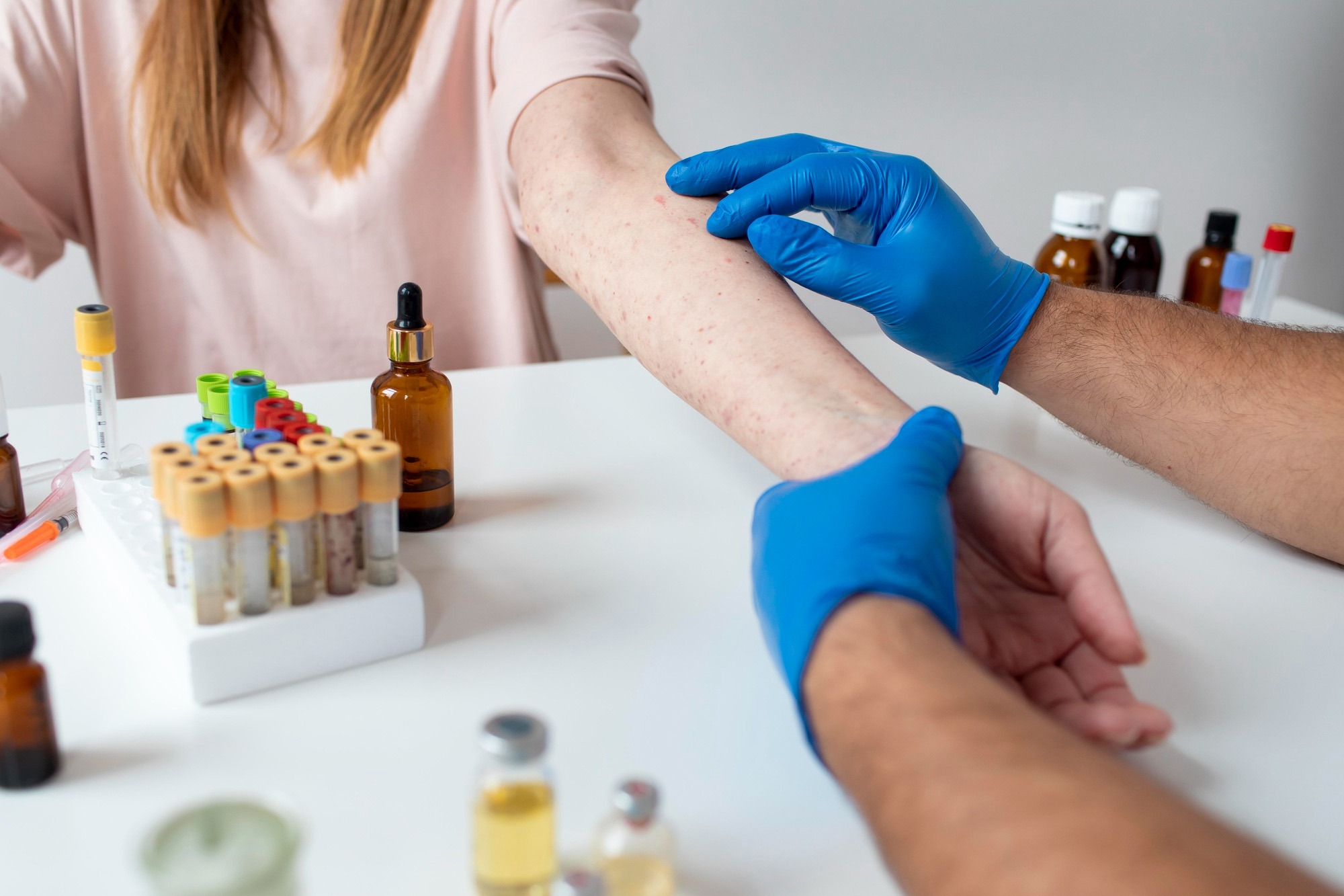 Allergy Blood Tests - Healthwatch by Shyft